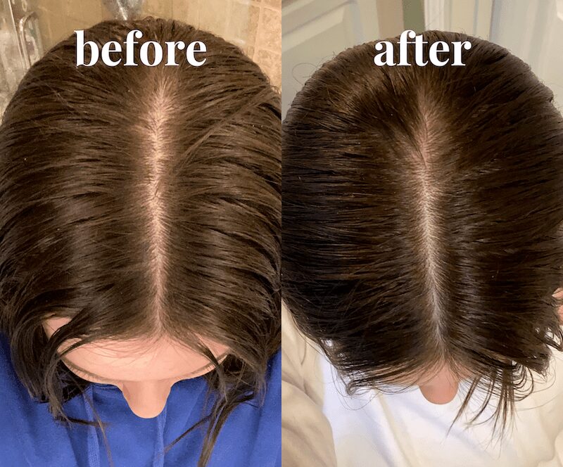 vegamour scalp detox before and after